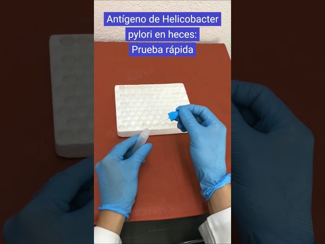 Detección de antígeno de Helicobacter pylori en heces #laboratorioclinico #shorts