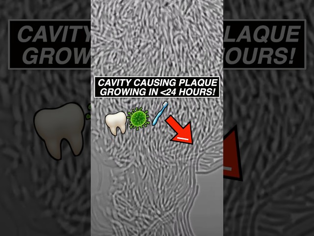 Watch how FAST cavity causing bacteria can grow in 24 hours! #dentist #microscope #biology #teeth