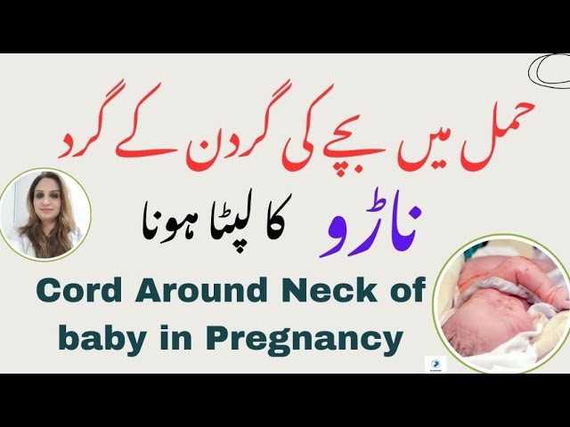 Cord Around the Neck of the baby in Pregnancy | حمل میں بچے کی گردن کے گرد ناڑو کا لپٹا ہونا