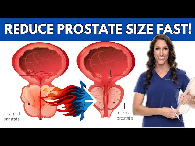 The ONE HERB That Shrinks Prostate Size & Weight