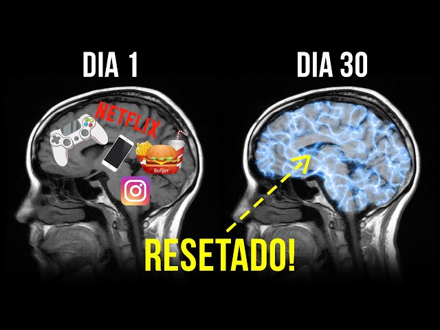 Após Isso O Seu Cérebro Será Resetado! | Psiquiatra Dra. Anna Lembke