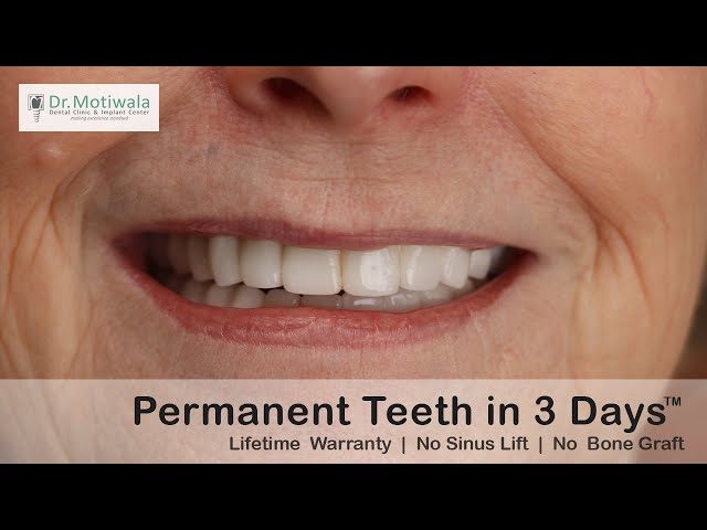 Sue from Carolina, USA shares her experience of full mouth dental implants in India | Dental Tourism