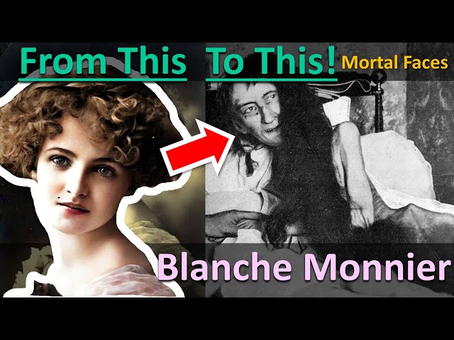 Desperate Mother Locked Up Beautiful Daughter for 25 Years: BLANCHE MONNIER