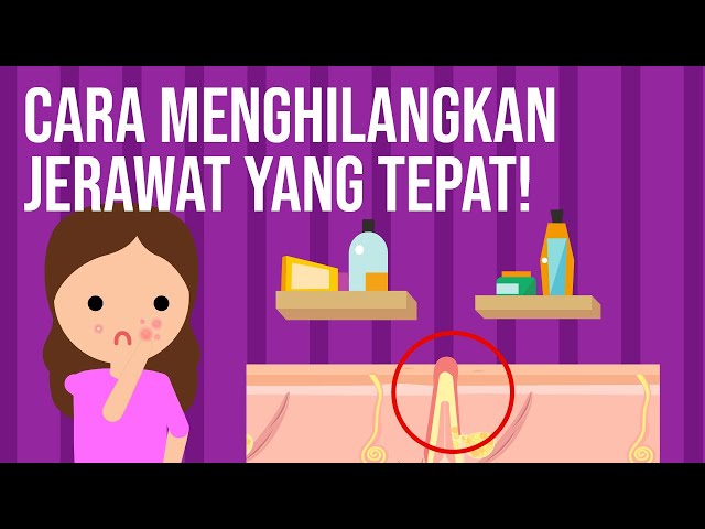 Cara Menghilangkan Jerawat