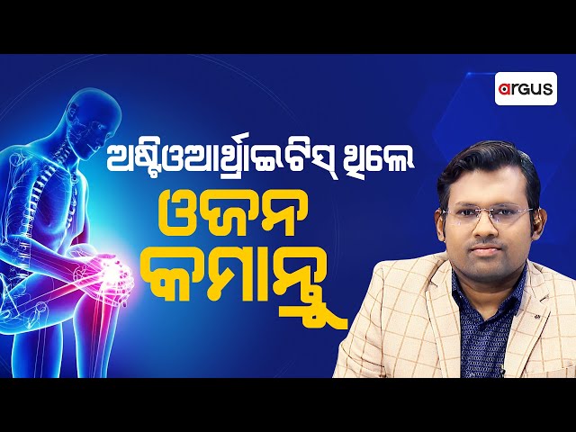 Prescription | ଅଷ୍ଟିଓଆର୍ଥ୍ରାଇଟିସ୍ ଥିଲେ ଓଜନ କମାନ୍ତୁ