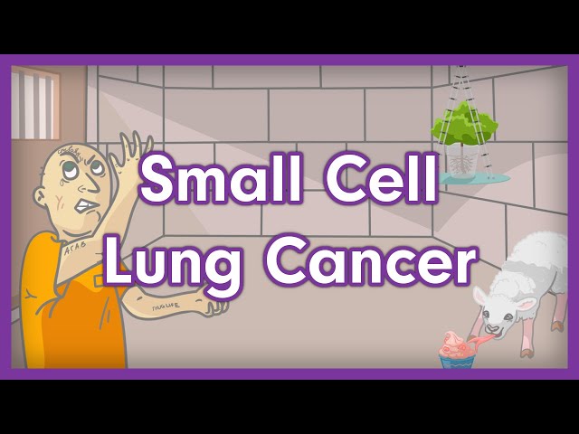 Small Cell Lung Cancer (Small Cell Carcinoma) | USMLE Step 1 Mnemonic