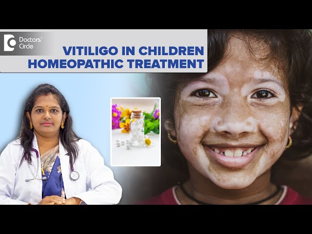 Vitiligo In Children Homeopathic Treatment | White Skin Patch - Dr. Vindoo C | Doctors' Circle