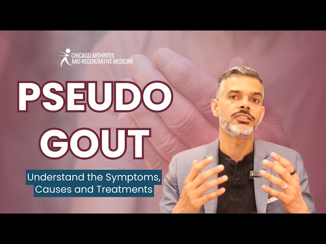 How to Treat Pseudogout & CPPD Crystals Effectively