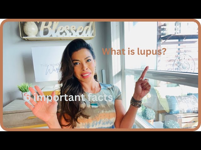 What is lupus? the five most important facts!