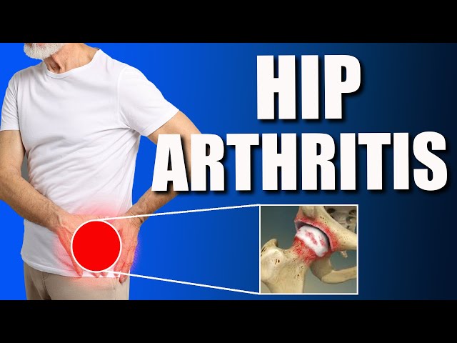 Hip Osteoarthritis (OA): Best Exercises for Pain Relief & Strengthening