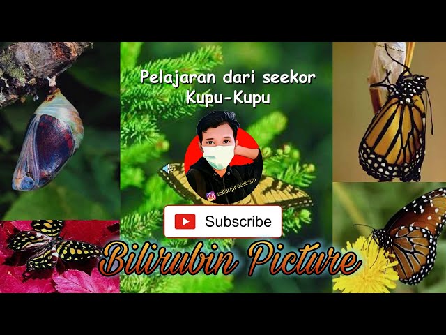 Motivasi Hidup "Pelajaran dari Seekor Kupu - Kupu"