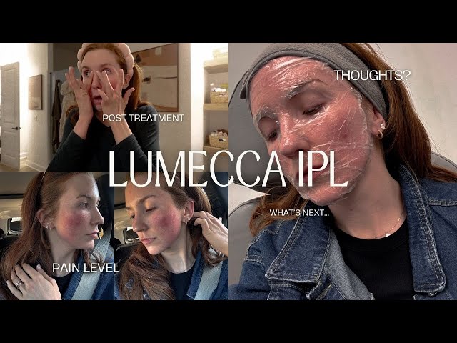 Lumecca IPL DAY 1: Thoughts? Pain? What's Next?!