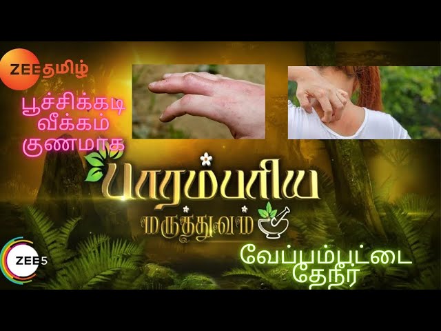 பூச்சிக்கடி வீக்கம் குறைய வேப்பம்பட்டை தேநீர் - Parambariya Maruthuvam - Ep 1806 - Zee Tamil