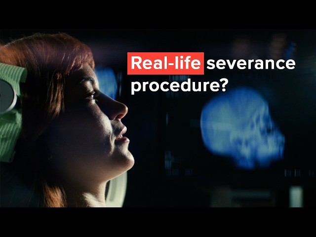 Severance Neuroscience Explained - Doorway Effect, Reintegration, Split Brain Surgery