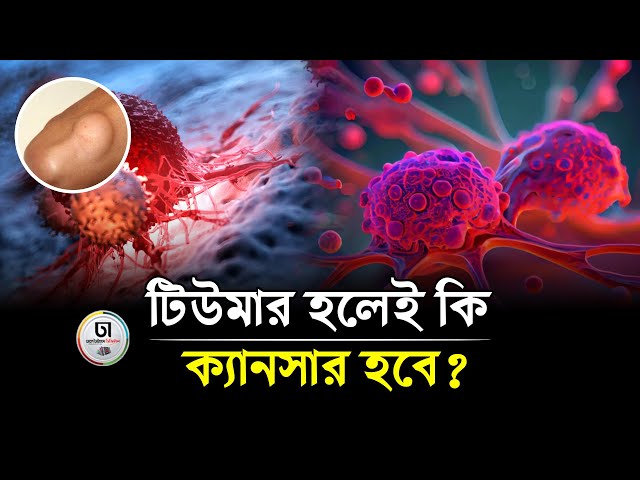 সব টিউমারই কি ক‌্যানসা‌রের কারণ? || tumor | Cancer | Dhaka Times Digital ||