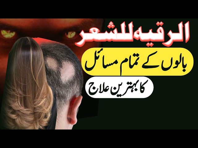 Girte Balon ka Rohani ilaj | Nazr E Bad Se Hair fall |Cure Of Ruqyah Shariah |  Al Sakinah