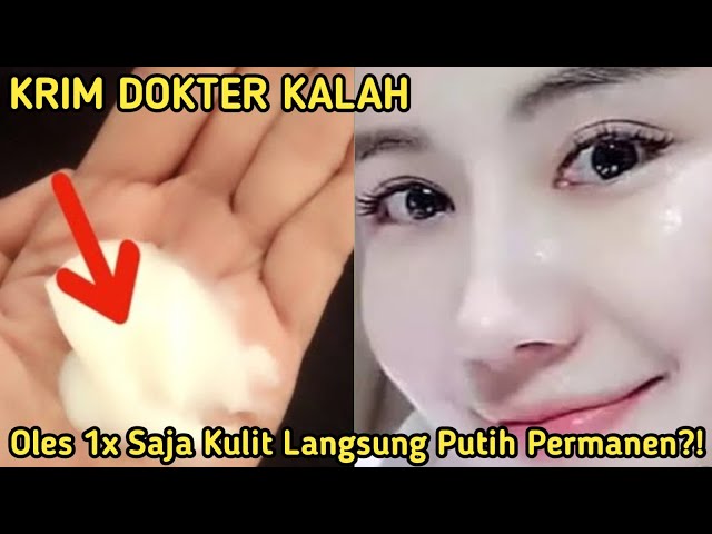 KRIM DOKTER KALAH!! OLES 1x SAJA KULIT LANGSUNG PUTIH PERMANEN?! CARA MEMUTIHKAN WAJAH PERMANEN