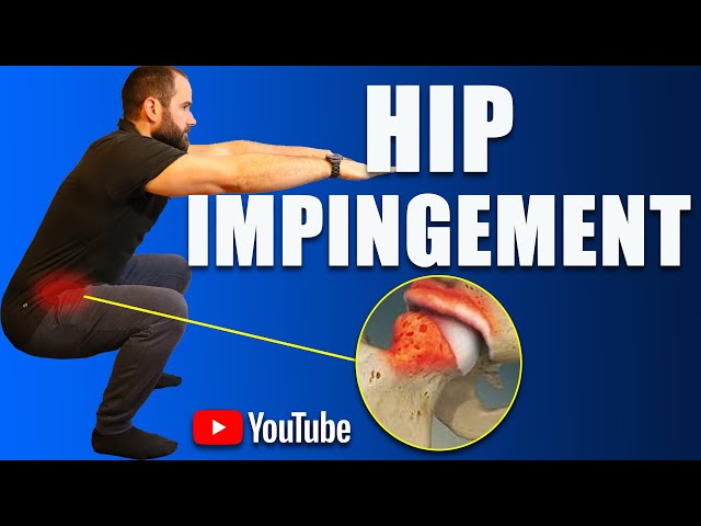 Hip Impingement Pain (FAI) Best Exercises, Rehab & Strengthening (How to Avoid Surgery)