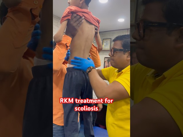 RKM treatment for scoliosis. #painfreeindia #RKM #drrajneeshkant