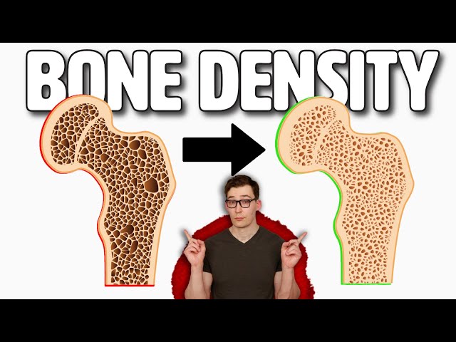 Boost your Bone Density with these 3 Tips!