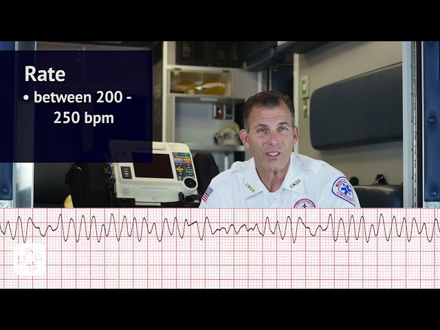 Ventricular Fibrillation (V-Fib) EKG/ECG (ACLS Rhythm Strips) | Training Video