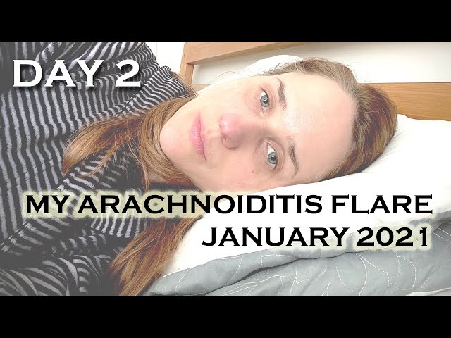 DAY 2 ARACHNOIDITIS & SPINAL CSF LEAK FLARE: January 2021