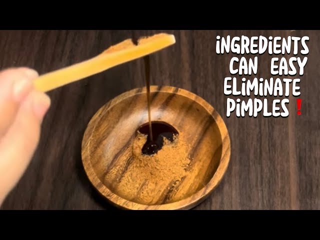 Ingredients can easy Eliminate pimples❗️