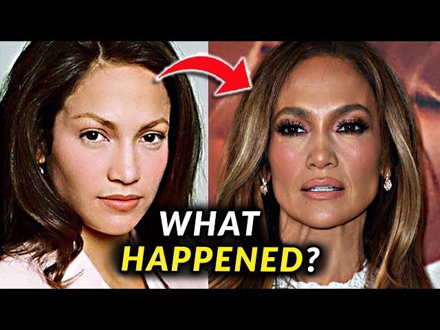 Jennifer Lopez's Face - Before and After