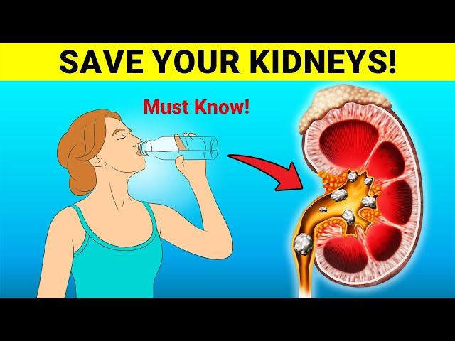 Top 8 Habits To Heal Your Kidneys and Prevent Kidney Stones