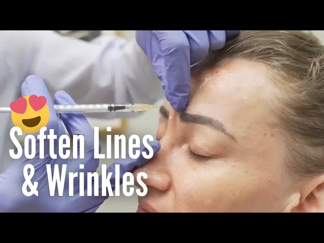 Minitox™ (Using Botox, Xeomin, Dysport and Jeaveau) Dr. Qazi's Signature Botox Technique