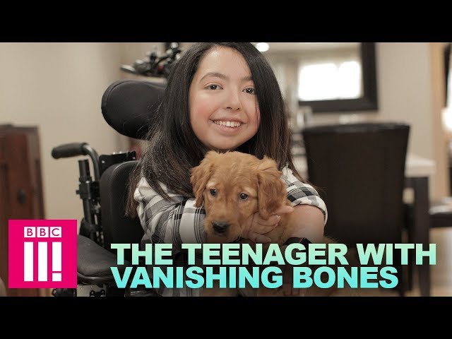 The Teenager with Vanishing Bones | Living Differently