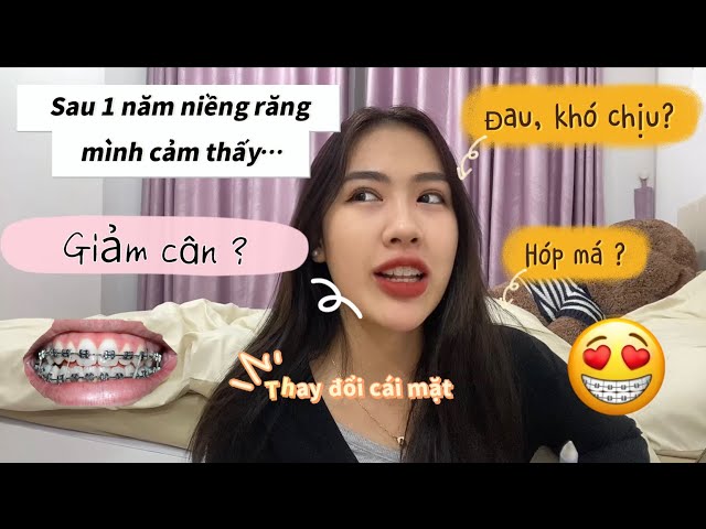 Những vấn đề về NIỀNG RĂNG ai cũng phải trải qua | Mình sau 1 năm đeo niềng răng| Huyentranggday