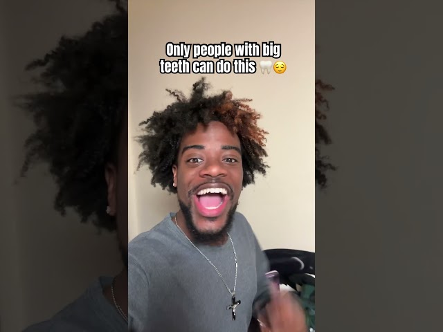 Where my big teeth gang at? 😂🔥 #thejiggyprince