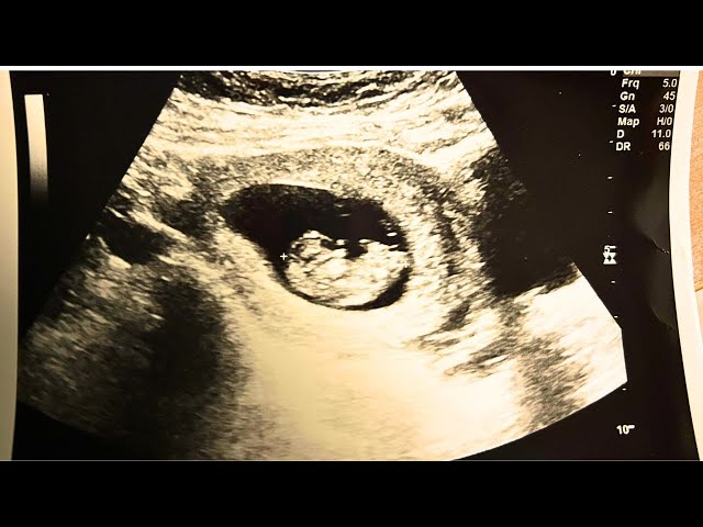 WE'RE HAVING A BABY!!!