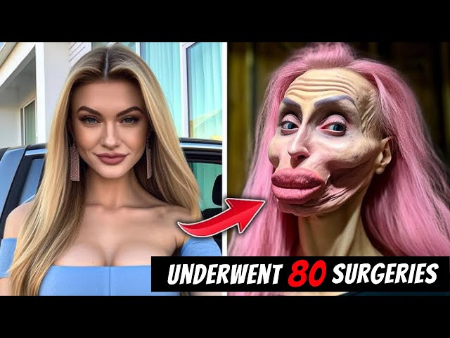 People Who Took Plastic Surgery Too Far