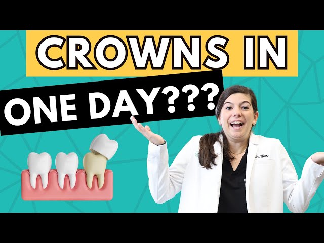 Upgrade Your Smile With Same Day Crowns | Dr. Miro