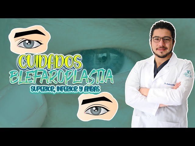 Cuidados después de una Blefaroplastia