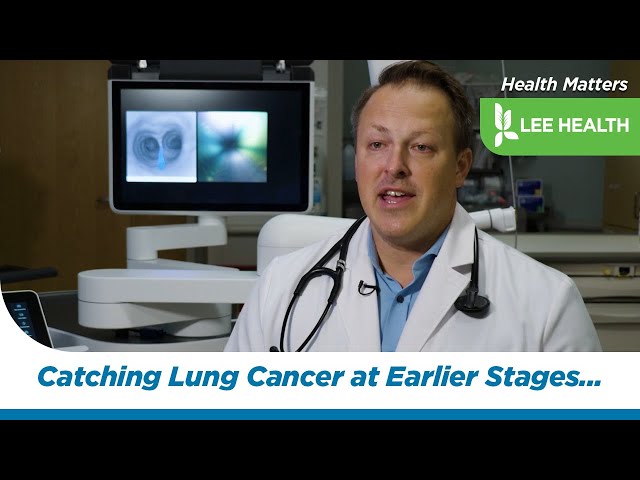 Catching Lung Cancer at Earlier Stages with ION