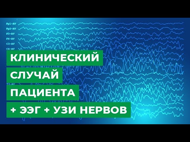 Клинический случай пациента + ЭЭГ + УЗИ нервов