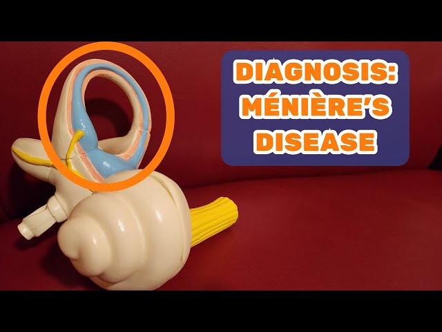 DIAGNOSIS: Ménière’s Disease - Dizzy Therapy