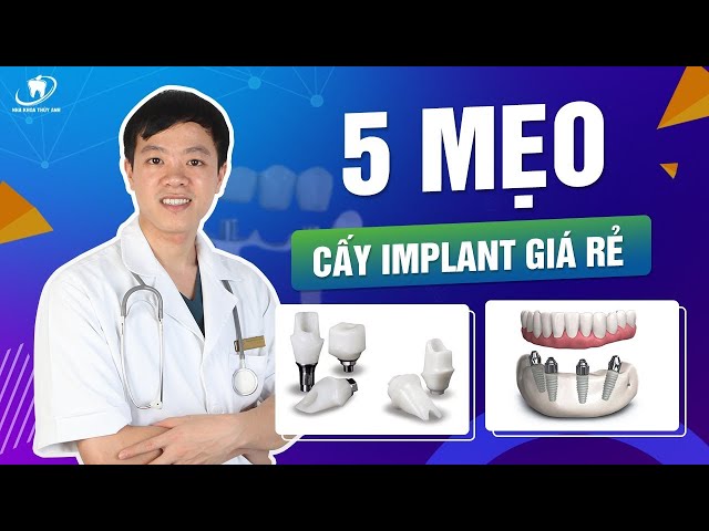 5 cách để trồng răng Implant với chi phí thấp nhất mà vẫn đem lại hiệu quả tuyệt vời