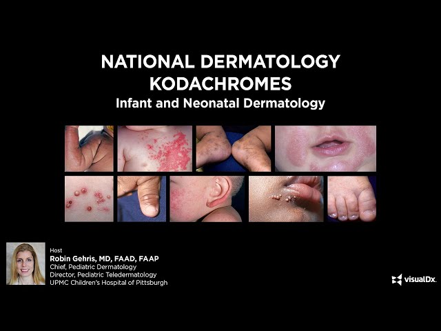 National Dermatology Kodachromes: Infant and Neonatal Dermatology