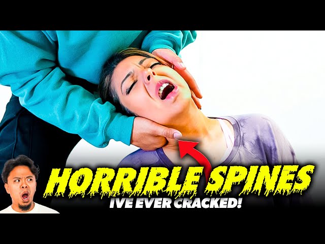 **THE WORST SPINES**IVE EVER CRACKED! 😭😱 | Asmr Back & Neck Pain | Dr Tubio