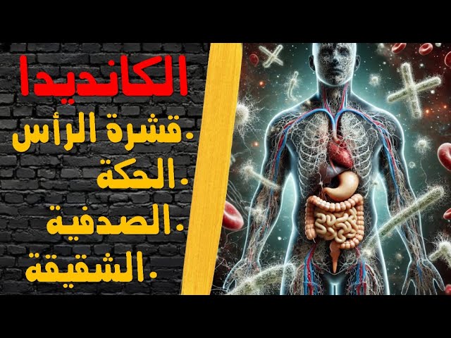 الكانديدا الفطر الخفي لي كيدمر جسمك في صمت 😲‼️ العلاج ساهل وبين يديك