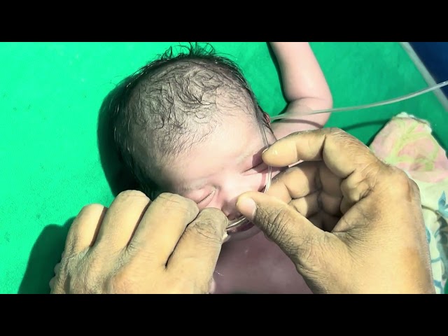 New Born baby baby 👌💕💕👩‍🍼#viralvideo #baby #cutebaby #cuteanimal #bantubabycare #cute #like #Born