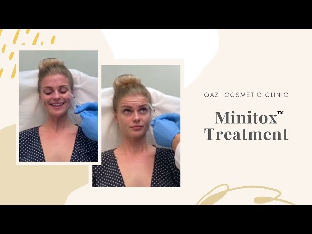 Minitox Injections | Live with Dr. Nadir Qazi