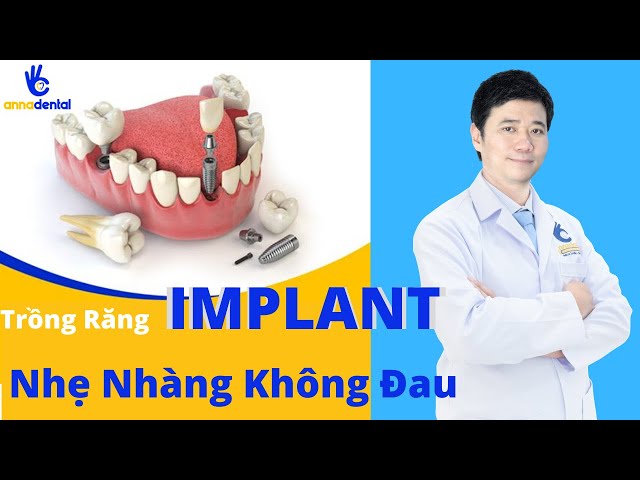 Trồng răng IMPLANT nhẹ nhàng như thế nào? có ĐAU không? | NHA KHOA ANNA