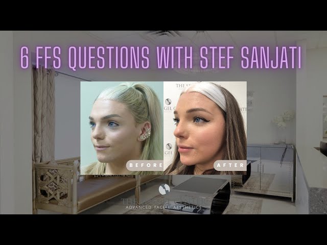 6 Facial Feminization Surgery Questions at The Spiegel Center with Stef Sanjati