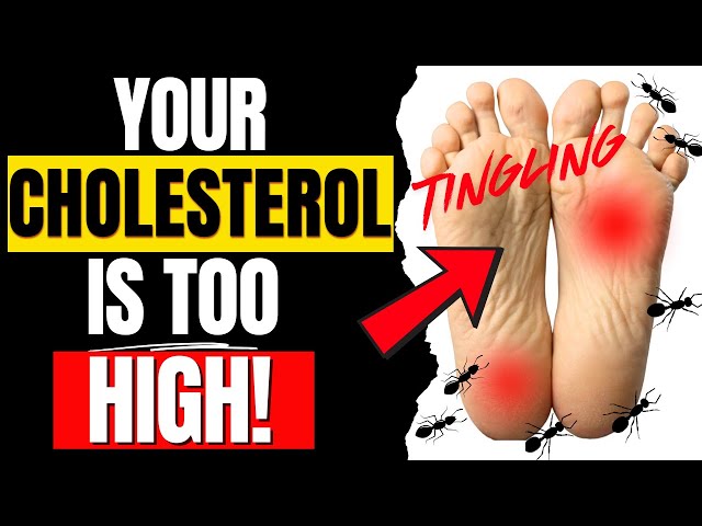 Watch Out For This Seniors! Must Know Signs of High Cholesterol