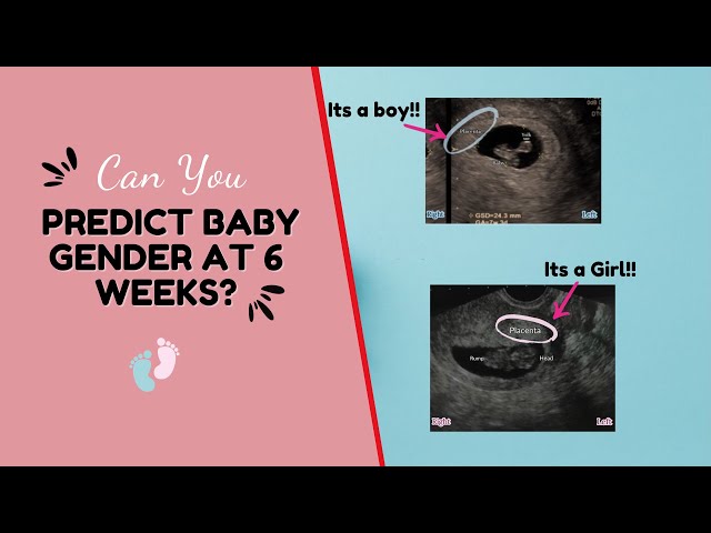 Can You Detect Baby's Gender at 6-8 Weeks Scan?  Boy or Girl?  The Ramzi Theory Gender Prediction